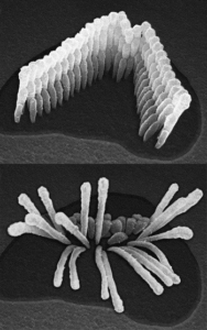 Ear cells comparison pictures