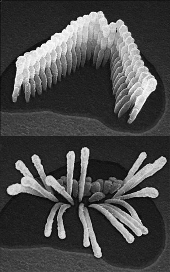 ear_cell_comparison